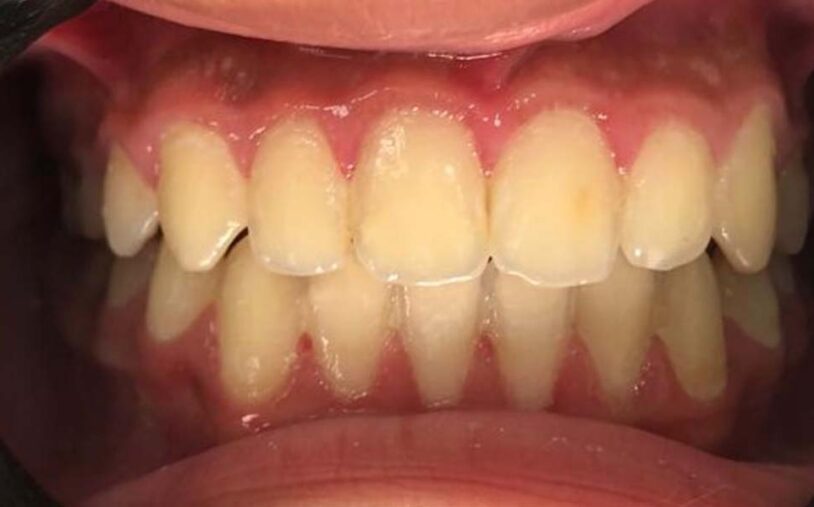 After - Priory House Dental Centre