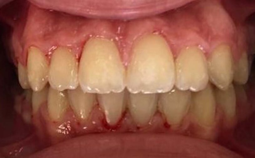 After - Priory House Dental Centre