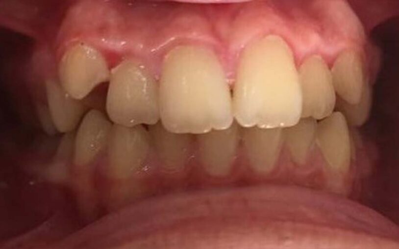 Before - Priory House Dental Centre