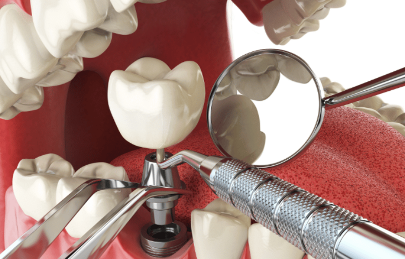 Patient Information - Priory House Dental